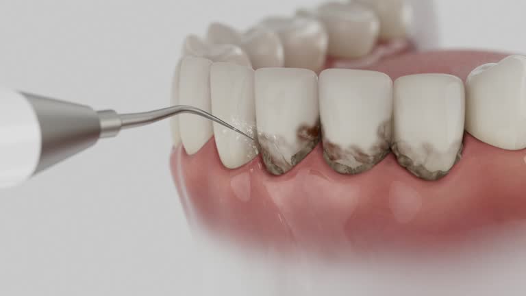 Trusted Root Canal Treatment service in Wesson, MS - Dentist Open Now